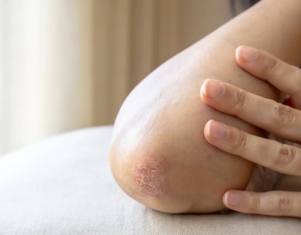 Jak zacząć dzień ze skórą atopową – od czego zależy skuteczna poranna rutyna?