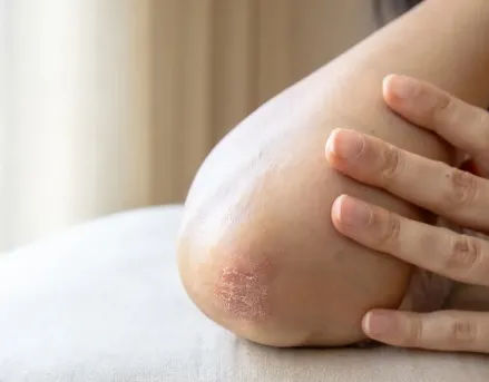 Jak zacząć dzień ze skórą atopową – od czego zależy skuteczna poranna rutyna?